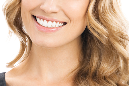 Veneers Veneers Mills River NC-Dentist Mills River Family Dental
