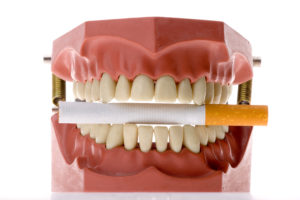 Why you Need to Know About Oral Cancer