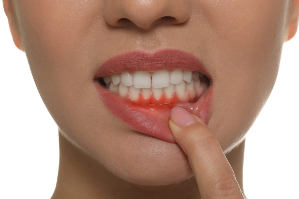 sensitive teeth during pregnancy