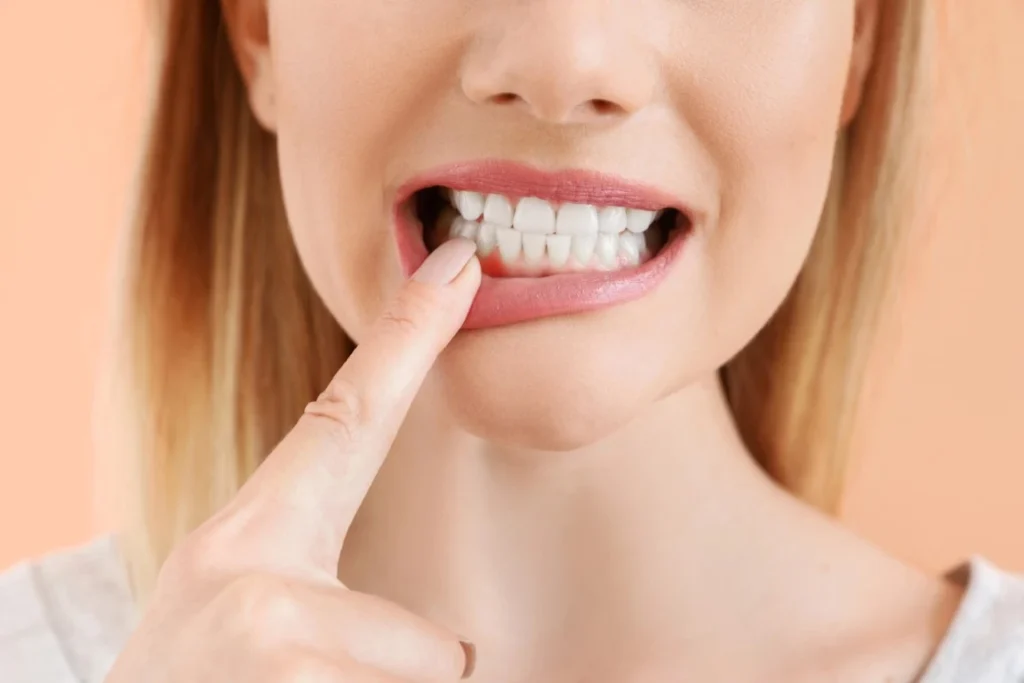 Why Do You Have Receding Gums? Receding Gums - Mills River Family Dental, Mills River, NC