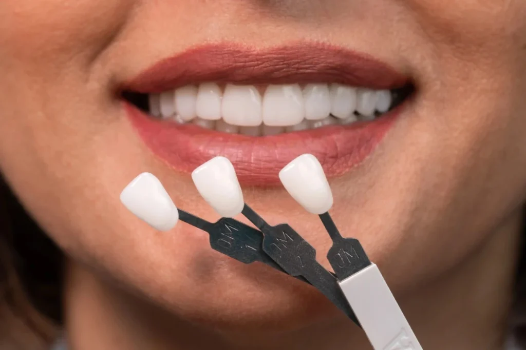 Why Do Your Veneers Keep Falling Out? 6 Common Causes And How To Address Them Veneers Keep Falling Out - Mills River, NC