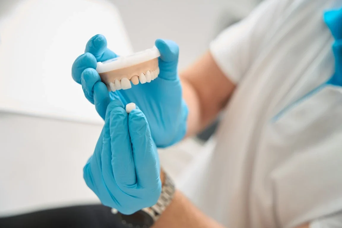 How Same-Day Dental Crowns Work: Go from Broken Tooth to Restored Smile in One Visit Crowns and Bridges - Mills River, NC