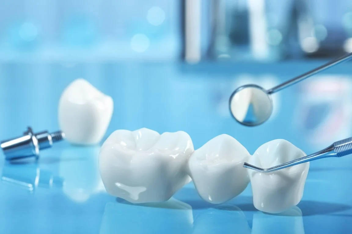 Maintaining Your Investment: How to Care for Crowns and Bridges 20 Years Later