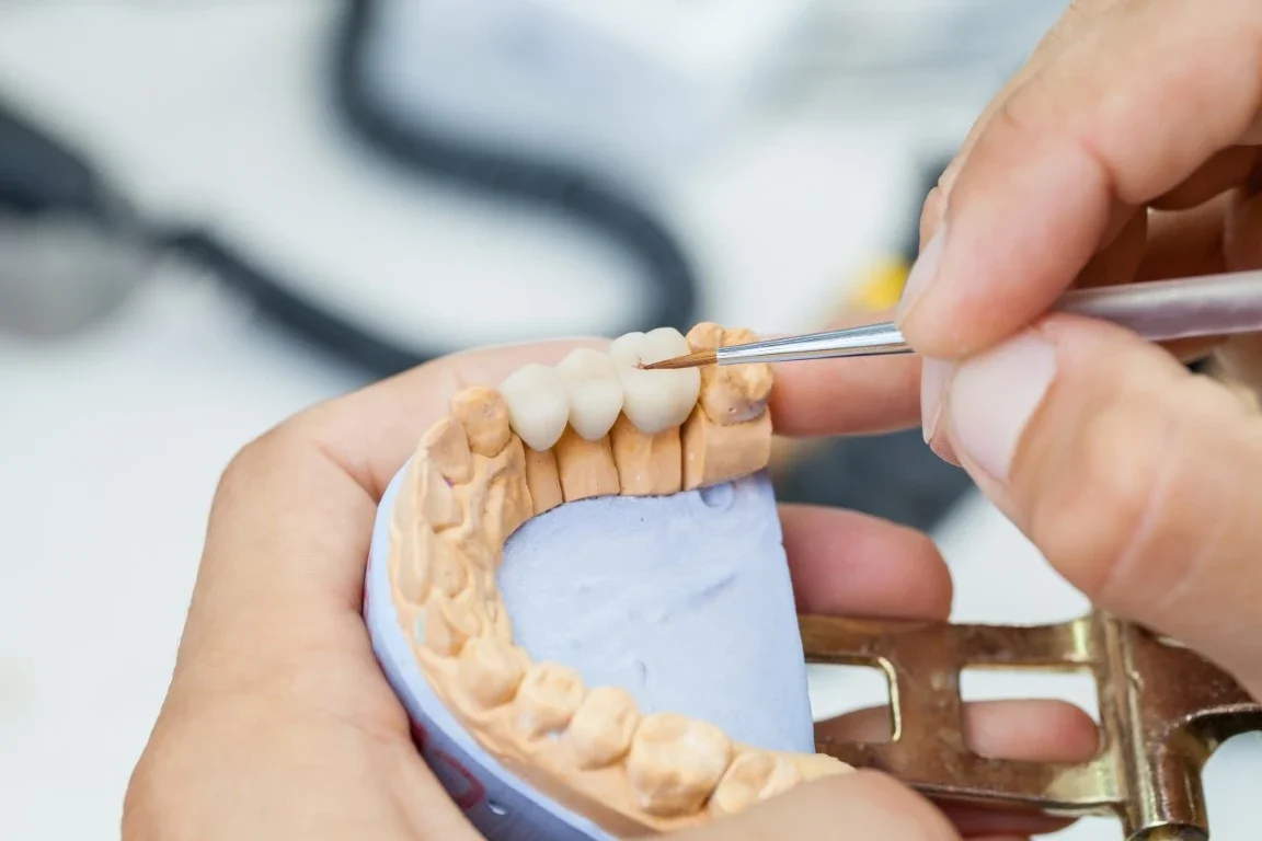 How Same-Day Dental Crowns Work: Go from Broken Tooth to Restored Smile in One Visit Crowns and Bridges - Mills River, NC